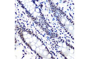 Immunohistochemistry of paraffin-embedded human colon using Phospho-IκBα-S36 Rabbit mAb (ABIN7268992) at dilution of 1:100 (40x lens). (NFKBIA anticorps  (pSer36))