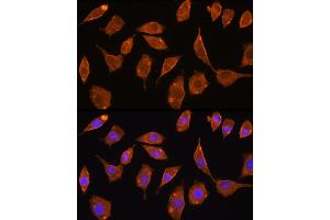 Immunofluorescence analysis of L929 cells using Thioredoxin reductase 2 (TXNRD2 ) antibody (ABIN6128856, ABIN6149741, ABIN6149742 and ABIN6221158) at dilution of 1:100.