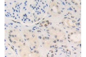 Detection of HMGN2 in Human Kidney Tissue using Polyclonal Antibody to High Mobility Group Nucleosome Binding Domain Containing Protein 2 (HMGN2)