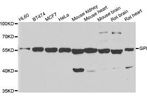 Western blot analysis of extracts of various cell lines, using GPI antibody. (GPI anticorps)