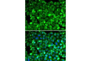 Immunofluorescence analysis of HeLa cell using RPLP1 antibody. (RPLP1 anticorps)