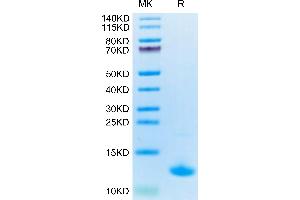 Chemokine (C-X-C Motif) Ligand 10 (CXCL10) (AA 27-91) protein (His tag)