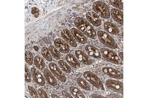 Immunohistochemical staining of human duodenum with UQCC polyclonal antibody  shows strong granular cytoplasmic positivity in glandular cells at 1:200-1:500 dilution. (Ubiquinol-Cytochrome C Reductase Complex Chaperone (UQCC) anticorps)