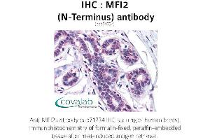 Image no. 1 for anti-Antigen P97 (Melanoma Associated) Identified By Monoclonal Antibodies 133.2 and 96.5 (MFI2) (N-Term) antibody (ABIN1736928)
