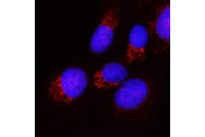 IF analysis of PPA2 using anti-PPA2 antibody (ABIN6719431). (PPA2 anticorps  (AA 33-334))