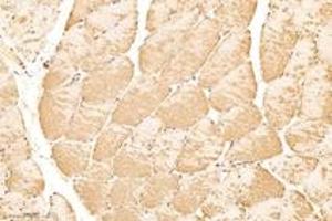 Immunohistochemistry analysis of paraffin-embedded rat skeletal muscle using,KPB1+2 (ABIN7074443) at dilution of 1: 3000 (KPB1/2 anticorps)