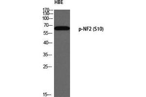 Western Blot (WB) analysis of HBE using p-NF2 (S10) antibody.
