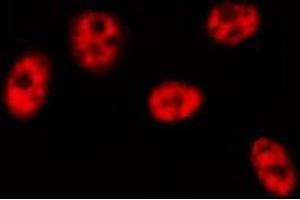 ABIN6274464 staining HeLa cells by IF/ICC. (BRF1 anticorps  (Internal Region))