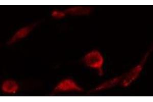 ABIN6278331 staining  A431 cells by IF/ICC. (PLCB3 anticorps  (C-Term))