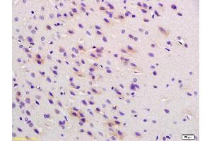Formalin-fixed and paraffin embedded rat brain labeled with Anti Phospho-Cofilin (Ser3) Polyclonal Antibody , Unconjugated at 1:200, followed by conjugation to the secondary antibody and DAB staining (Cofilin anticorps  (pSer3))