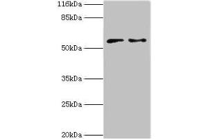 Western blot All lanes: CRISPLD2 antibody at 2 μg/mL Lane 1: Jurkat whole cell lysate Lane 2: CEM whole cell lysate Secondary Goat polyclonal to rabbit IgG at 1/10000 dilution Predicted band size: 56, 52, 43, 18, 14 kDa Observed band size: 56 kDa (CRISPLD2 anticorps  (AA 40-305))