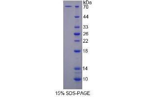 SDS-PAGE (SDS) image for Surfeit 1 (SURF1) (AA 1-306) protein (His tag,GST tag) (ABIN6239480)