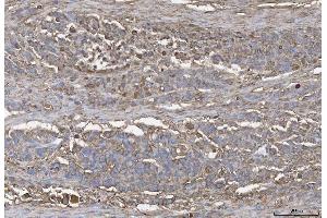 IHC analysis of ANXA4 using anti-ANXA4 antibody (ABIN5518805). (Annexin IV anticorps  (Middle Region))