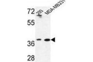 Western Blotting (WB) image for anti-Methionine Adenosyltransferase II, beta (MAT2B) antibody (ABIN3004219) (MAT2B anticorps)
