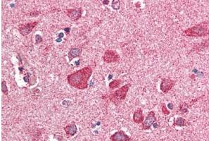 Human Brain, Cortex (formalin-fixed, paraffin-embedded) stained with PITPNM3 antibody ABIN337021 at 5 ug/ml followed by biotinylated anti-goat IgG secondary antibody ABIN481715, alkaline phosphatase-streptavidin and chromogen. (NIR1 anticorps  (AA 962-974))