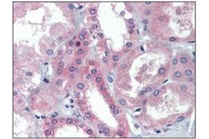 Immunohistochemistry (IHC) image for anti-BRCA1/BRCA2-Containing Complex, Subunit 3 (BRCC3) (AA 1-316), (N-Term) antibody (ABIN400864)