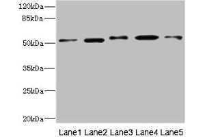 Western blot All lanes: NFKBIE antibody at 4. (NFKBIE anticorps  (AA 140-280))