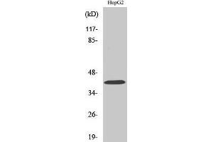 Western Blotting (WB) image for anti-Ribosomal Modification Protein RimK-Like Family Member B (RIMKLB) (Internal Region) antibody (ABIN3175055) (RIMKLB anticorps  (Internal Region))