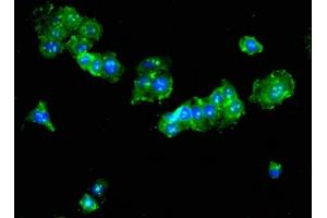 Immunofluorescent analysis of HepG2 cells using ABIN7173992 at dilution of 1:100 and Alexa Fluor 488-congugated AffiniPure Goat Anti-Rabbit IgG(H+L) (Tat (AA 25-111) anticorps)