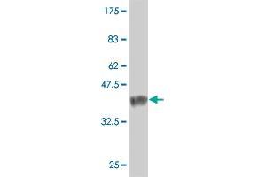 Western Blot detection against Immunogen (37. (NXNL1 anticorps  (AA 81-190))