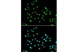 Immunofluorescence analysis of  cells using SM antibody (ABIN6131360, ABIN6148103, ABIN6148105 and ABIN6221551). (SMARCAD1 anticorps  (AA 1-300))