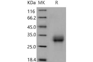 Western Blotting (WB) image for Bone Morphogenetic Protein Receptor 1A (BMPR1A) (Active) protein (His tag) (ABIN7320449)