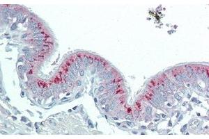 Detection of HAO1 in Human Lung Tissue using Polyclonal Antibody to Hydroxyacid Oxidase 1 (HAO1)