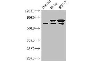 Western Blot Positive WB detected in: Jurkat whole cell lysate, Hela whole cell lysate, MCF-7 whole cell lysate All lanes: INTS9 antibody at 3. (INTS9 anticorps  (AA 368-658))