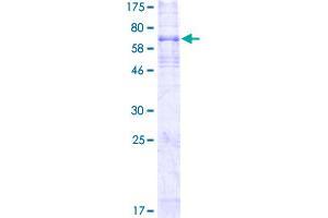 Image no. 1 for Endothelin Receptor Type B (EDNRB) (AA 1-442) protein (GST tag) (ABIN1352332)