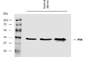 Detection of Human prostate-specific antigen (PSA) by Western Blot.