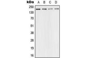 Western blot analysis of 53BP1 expression in HeLa (A), SP2/0 (B), PC12 (C), rat kidney (D) whole cell lysates.