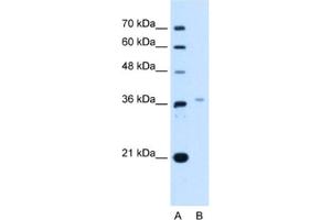 Western Blotting (WB) image for anti-LIM Homeobox 8 (LHX8) antibody (ABIN2463069) (LHX8 anticorps)
