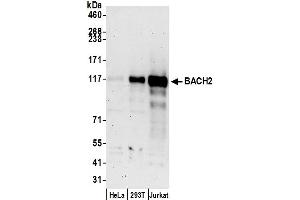 Western Blotting (WB) image for anti-BTB and CNC Homology 1, Basic Leucine Zipper Transcription Factor 2 (BACH2) (AA 791-841) antibody (ABIN7450016)
