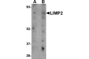 Western Blotting (WB) image for anti-Scavenger Receptor Class B, Member 2 (SCARB2) (C-Term) antibody (ABIN1030483) (SCARB2 anticorps  (C-Term))