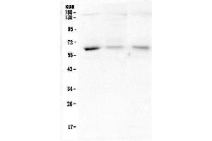 Western blot analysis of ARSA using anti-ARSA antibody (ABIN5692787). (Arylsulfatase A anticorps  (C-Term))