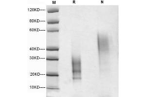 5 μg of IL-13, Human was resolved with SDS-PAGE under reducing (R) and non-reducing (N) conditions and visualized by Coomassie Blue staining. (IL-13 Protein (AA 19-132))