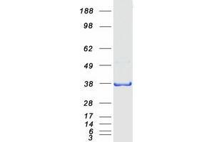 Validation with Western Blot