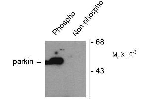 Western blots of HEK293 cells transfected with Parkin WT (Phospho) and Parkin S101 mutant (non-phospho) showing the phospho-specific immunolabeling of the ~ 52 k parkin protein. (Parkin anticorps  (pSer101))