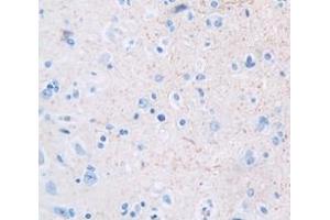 IHC-P analysis of Kidney tissue, with DAB staining. (GDF10 anticorps  (AA 1-288))