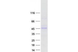 Validation with Western Blot