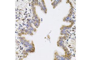 Immunohistochemistry of paraffin-embedded human lung using SPR antibody. (SPR anticorps)