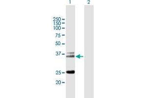 Western Blot analysis of TRA@ expression in transfected 293T cell line by TRA@ MaxPab polyclonal antibody. (TCR alpha anticorps  (AA 1-278))