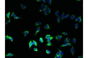 Immunofluorescent analysis of A375 cells using ABIN7155613 at dilution of 1:100 and Alexa Fluor 488-congugated AffiniPure Goat Anti-Rabbit IgG(H+L)