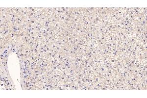 Detection of PIIINP in Human Liver Tissue using Monoclonal Antibody to Procollagen III N-Terminal Propeptide (PIIINP)