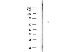Western blot analysis of lysates from Raji cells(heat-shock,45 min treatment), using L Antibody at 1/1000 dilution.