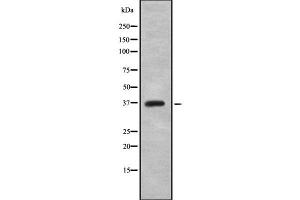 Western blot analysis of CTSS using HuvEc whole cell lysates
