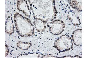 Image no. 3 for anti-Aminoacylase 1 (ACY1) antibody (ABIN1496454) (Aminoacylase 1 anticorps)