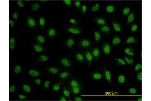Immunofluorescence of monoclonal antibody to BCL9 on HeLa cell. (BCL9 anticorps  (AA 1036-1135))