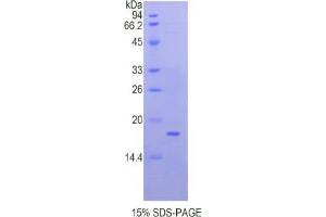 SDS-PAGE analysis of Human QSOX1 Protein.