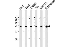 All lanes : Anti-RPL10 Antibody (N-term) at 1:2000 dilution Lane 1: Hela whole cell lysate Lane 2: Daudi whole cell lysate Lane 3: U266B1 whole cell lysate Lane 4: 293 whole cell lysate Lane 5: NIH/3T3 whole cell lysate Lane 6: Rat pancreas lysate Lysates/proteins at 20 μg per lane.